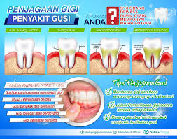 Peningkatan hormon yang dihasilkan oleh badan semasa anda mengandung boleh meningkatkan. Gusi Bengkak Dan Sakit Sang Hook