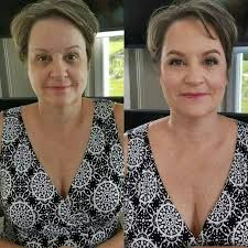 What does a whitening patch