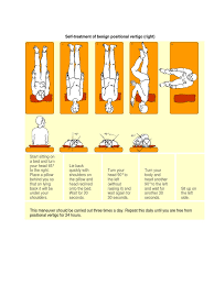 This maneuver should be carried out three times a day. Home Epley Handouts Medical Specialties Clinical Medicine