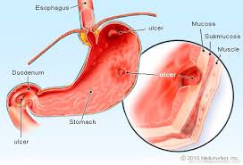 The liver is also supplied w/ blood by a second vessel, the hepatic portal vein. Liver Picture Image On Medicinenet Com