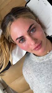 Olivia Amato Face Change