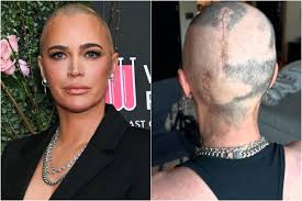 It's been 76 days since she rushed to the ER with unbearable headaches —  only to receive a devastating diagnosis: multiple stage 4 tumors “the size  of plums” had spread to her