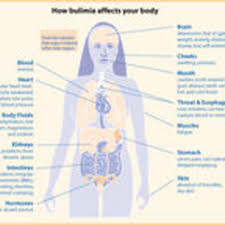 Bulimia An Integrated Map Of Nine Key Elements Psychology