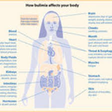 bulimia an integrated map of nine key elements psychology