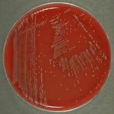 Detection and enumeration of listeria monocytogenes in foods. Listeria Monocytogenes