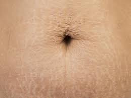 Check out the related q&as for additional details on hair removal techniques. Is It Safe To Use Bleaching Products For Body Hair During Pregnancy Babycentre Uk