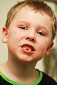 Cirkus Svorkås: mars 2010