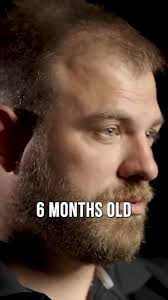 9 Doctors And 7 Nurses Worked On Me For 14 Hours