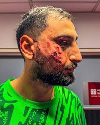 THE STAPLES! I know you understand but it bears repeating, we play a  collision position. This GK is Donnarumma and he is one of the best in the  world. No red card