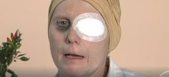 Dopo il tumore, l'ictus: Daniela vuole riabbracciare la sua mamma