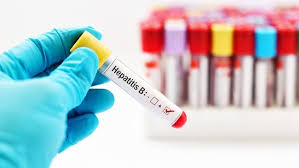 We did not find results for: Hari Hepatitis Sedunia Jenis Gejala Pencegahan Penyakit
