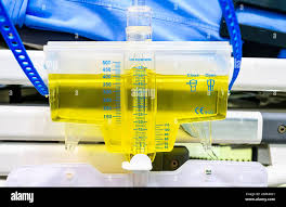 Image result for Urine Output