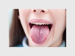 Image result for cancer tongue symptoms)
