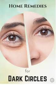 Do You Have Bags Under Your Eyes And Are They Causing You An Unwanted Headache The Reasons Behind Getting These May Vary But Some Dark Circles Eye Care Skin