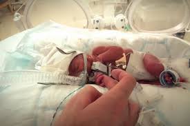 Resultado de imagen de nacimiento de hijos prematuros animado