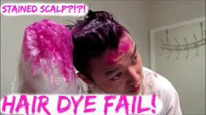Hilarious Diy Hair Dye Fail Stained Scalp Youtube