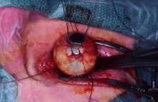 Image result for eyeball enucleation cattle