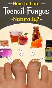 Pin By Patsy Gomez On Toenail Fungus Home Remedies Toenail Fungus Cure Toenail Fungus Remedies Toenail Fungus Treatment