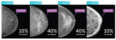 Breast Density