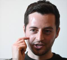 Ryan mason has been forced to retire from football as a result of the fractured skull the hull city midfielder suffered in their premier league match with. Ryan Mason It Was Like A Bomb Going Off In My Head Daily Mail Online