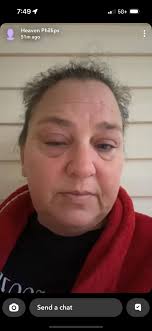 Rose. She had a bad infection in her right eye. Very bad. Couldn't catch  her. So, Nancy made sure she got supplements in her food. Mixed with  prayer, her URI and eye