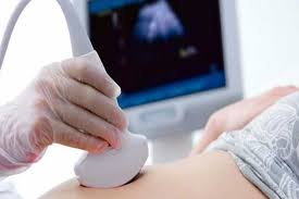 Maybe you would like to learn more about one of these? Edomex Segunda Entidad Con Mayor Interrupcion Legal Del Embarazo