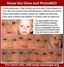 Should you get your child checked for skin cancer? Photored Technique We C Hope