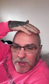 Do I still look good bald?