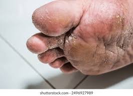 Image result for Tinnea vesiculosa