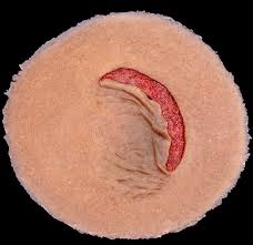 Image result for Skin Tear