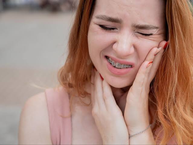 Help With Broken Braces in Windermere and Orlando | MyFamily Orthodontics
