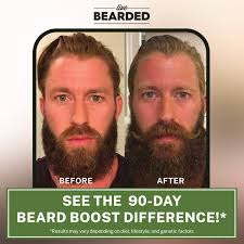 However, hair loss and brittle nails may have multiple causes and taking biotin supplements may actually. Buy Live Bearded Beard Boost Beard Hair Growth Multivitamins With Biotin 10 000mcg Vitamin C Vitamin E And Zinc 90 Day Supply Thick Strong Full Beard Growth Support Made In