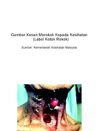 Tak sangka, disebabkan kesan merokok, imraz asyik selsema, batuk berkahak, dan paling mengejutkan, lepas menyusu dia muntah semahunya sampai susah bernafas. Gambar Kesan Merokok Kepada Kesihatan