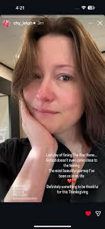 To say this doesn't hurt would be an understatement.