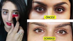 Gebelikte Goz Alti Morluklari Nedir Hamilelik Com Tr
