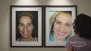Cosmetic Dentist Plano