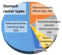 In fact, a large group of oncologic patients, especially those suffering. Stomach Cancer Wikipedia