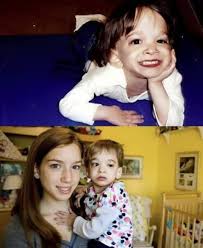 Vangelis - La mujer que no envejecía Brooke Greenberg, una joven  estadounidense nacida con un extraño síndrome que detuvo Su crecimiento a  los dos años, ha muerto a los 20 años de
