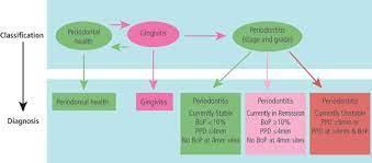 Periodontal Diagnosis In The Context Of The 2017 Classification System Of Periodontal Diseases And Conditions Implementation In Clinical Practice British Dental Journal