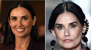 I have had something done but it's . Demi Moore Fuels Botched Plastic Surgery Speculation After Netizens Claim She Looks Unrecognizable Photos Nestia