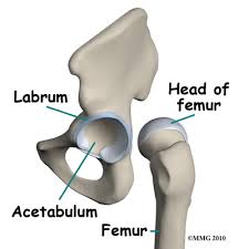 Image result for Hip Labral Tear