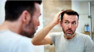 It's clinically proven to reduce hair fall by 94 percent, irrespective of the hair fall reason. Going Bald Effective Remedies To Reduce Hair Fall In Men Newsbytes
