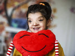 Image result for Hypertelis