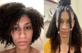 Shop the treatment for natural hair range online at superdrug. Mum S Struggle With Psoriasis Inspires Natural Products For Black Hair Voice Online