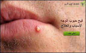 أسباب وعلاج ظهور القيح في حبوب الوجه nose ring