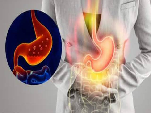 6 biện pháp tại nhà khắc phục chứng trào ngược axit dạ dày