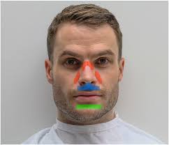 Interfaces for Home Noninvasive Ventilation