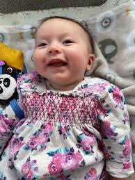 Barrow parents fundraise for helmet treatment for baby with Plagiocephaly