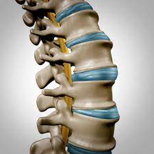 Weitere ideen zu bandscheiben, anatomie, anatomie und physiologie. Bandscheibenvorfall Schmerzfrei Ohne Tabletten Und Op Liebscher Bracht