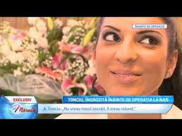 Desi tremura de frica, vedeta a hotarat ca este momentul sa faca aceasta schimbare de care toata lumea ii spunea de ani buni. Andrea Tonciu Operatie Nas Esteworld Youtube